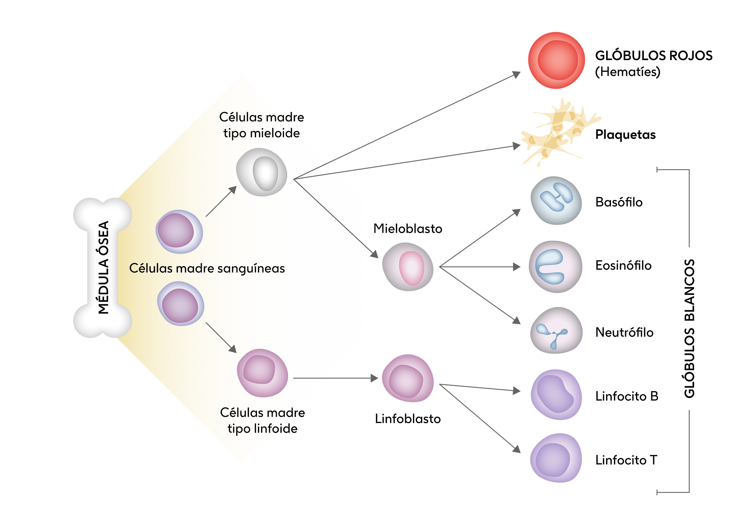 neoplasia mieloproliferativa
