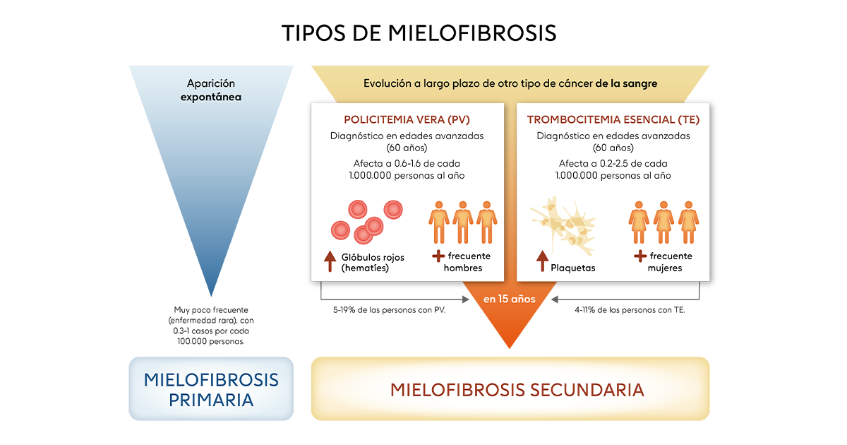 Tipos de mielofibrosis