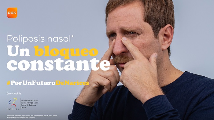 La Poliposis Nasal: un bloqueo constante