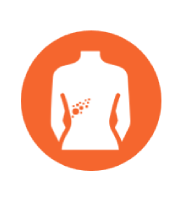 Infografía síntomas Herpes Zóster, ampollas, dolor, sarpullido